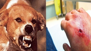 Trong một buổi chiều, 3 người bị chó dại cắn