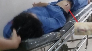 Đối tượng đâm cán bộ Cục thuế Ninh Bình khai gì tại cơ quan Công an?