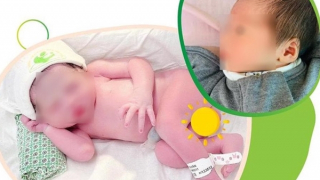 Em bé chào đời khoẻ mạnh từ người mẹ ghép thận