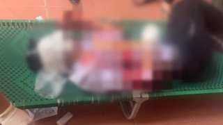 Giáo viên vừa rời khỏi lớp, nam sinh bị bạn chém thương tích