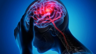 Cảnh báo nguy hiểm khi uống An cung thường xuyên phòng đột quỵ não