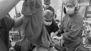 Ngã từ tầng 5 công trình, nam công nhân bị 3 cọc sắt đâm xuyên người