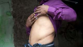 Châu Phi: Nhức nhối “thị trường” nội tạng người