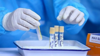 Ca mắc COVID-19 thấp nhất trong hơn 1 tháng qua