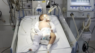 Bé gái hơn 2 tháng tuổi bị bạo hành dã man được xuất viện