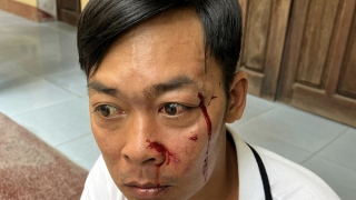 Điều tra vụ việc người đàn ông bị hành hung khi vừa rời trụ sở Tòa án