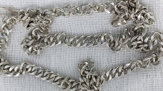 Bé gái 6 tuổi nuốt sợi dây chuyền "khủng" vào bụng