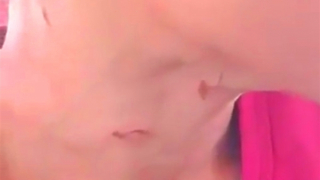 Cha dượng dùng lửa đốt "của quý" bé trai 14 tuổi