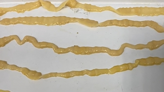 Hãi hùng thói quen ăn thực phẩm sống, tái