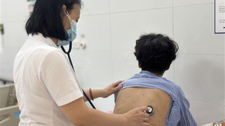 Cảnh báo gia tăng người trẻ mắc bệnh lao