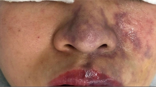 Tràn lan “lò” đào tạo chuyên gia thẩm mỹ “chui”