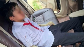 Nổ bóng bay, 7 học sinh nhập viện trong ngày khai giảng