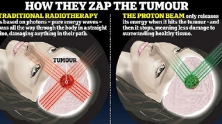 Liệu pháp chùm tia proton “cứu cánh” cho bệnh nhân ung thư?
