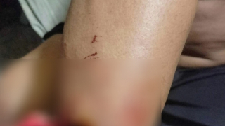 Cướp tài sản xong còn bắt nạn nhân nấu mì để ăn