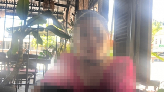 Mũi bị biến dạng sau phẫu thuật, khách hàng “tố” thẩm mỹ viện