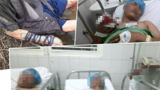 Mâu thuẫn cho thuê đất ruộng, 4 cha con bị chém trọng thương