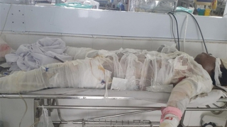 Năm người thương vong từ vụ chủ nhà dùng xăng đốt phòng ngủ