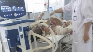 Thêm một người tử vong trong vụ chủ nhà tạt xăng đốt phòng ngủ