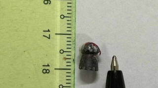 Người đàn ông đi làm rẫy bất ngờ bị “đạn lạc” gây thủng ngực