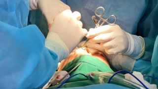 Gặp họa vì nâng mũi chỉ sinh học collagen