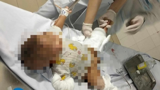 Mâu thuẫn đòi nợ, ném chai xăng đốt nhà khiến 3 người bị thương