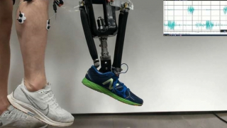 Mắt cá chân giả cải thiện chuyển động