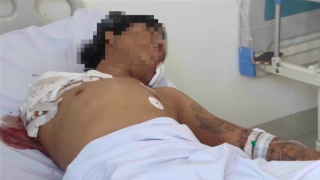 Chém đứt lìa cánh tay vì lái xe nẹt pô khiêu khích