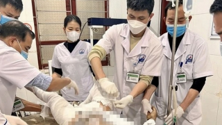 Cãi nhau với vợ, chồng đổ nửa can xăng tự thiêu