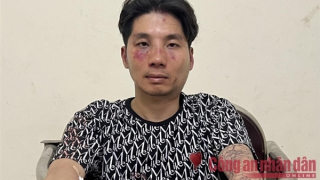 Đối tượng đâm trọng thương Công an bị tạm giữ về hành vi cướp tài sản, chống người thi hành công vụ