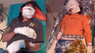 Điện thoại phát nổ, hai vợ chồng bị bỏng nặng