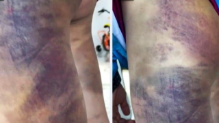 Tỉnh Lâm Đồng chỉ đạo làm rõ vụ nam sinh bị bạn đánh dã man