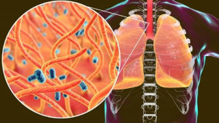 Tăng mạnh trẻ mắc ho gà
