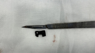 Bị mắt xích máy cưa đâm xuyên bụng khi cắt gỗ