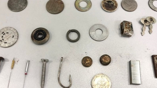 Cảnh báo những dị vật trẻ em nuốt phải