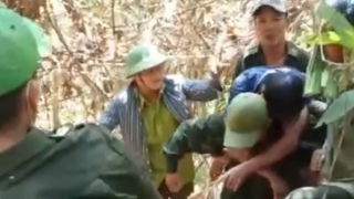 Bị bỏng nặng vì đốt lửa lấy mật ong rừng