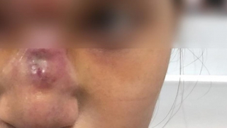 Bát nháo thẩm mỹ “chui”