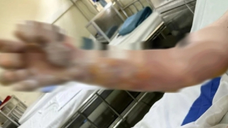 2 người bị bỏng nặng trong lúc đốt rác