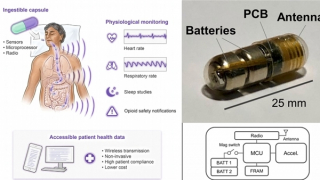 Theo dõi sức khỏe từ bên trong cơ thể
