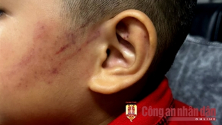 Vụ cô giáo "quờ tay tím má": Không khởi tố vụ án hình sự