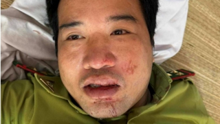 Bị yêu cầu dừng xe, tài xế lao ô tô thẳng vào Trạm trưởng kiểm lâm