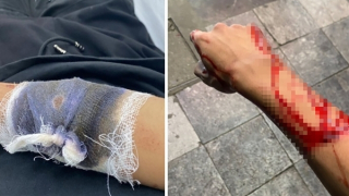 Cảnh sát vào cuộc vụ thanh niên bị chém và cướp xe máy trước cửa Nhà hát Lớn