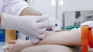 Những loại xét nghiệm nào không cần nhịn ăn