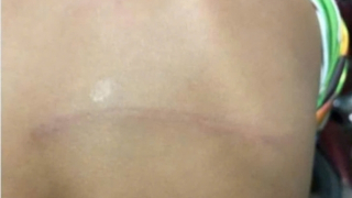 Kỷ luật giáo viên dùng dây điện đánh học sinh lớp 2