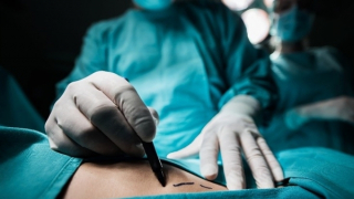 Từ chối điều trị, khối u tăng lên 2kg sau 1 năm, đè xẹp phổi