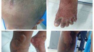 Truy tìm cha của bé trai 6 tuổi nghi bị bạo hành để làm rõ vụ việc