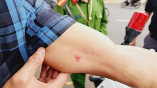 Thông tin ban đầu về việc phóng viên Báo CAND bị hành hung khi tác nghiệp