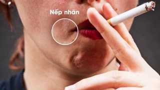 Hút thuốc lá làm tăng quá trình lão hoá, sớm xuất hiện các nếp nhăn