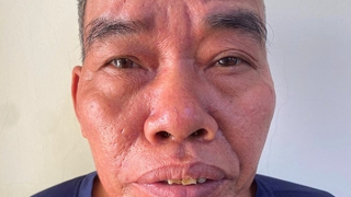 Bắt giữ đối tượng U60 hành hung Công an