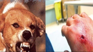 Chó dại cắn nhiều người, một cụ bà gần 90 tuổi tử vong