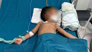 Gia đình chủ quan, bé trai bị rắn lục đuôi đỏ cắn dẫn đến nguy kịch